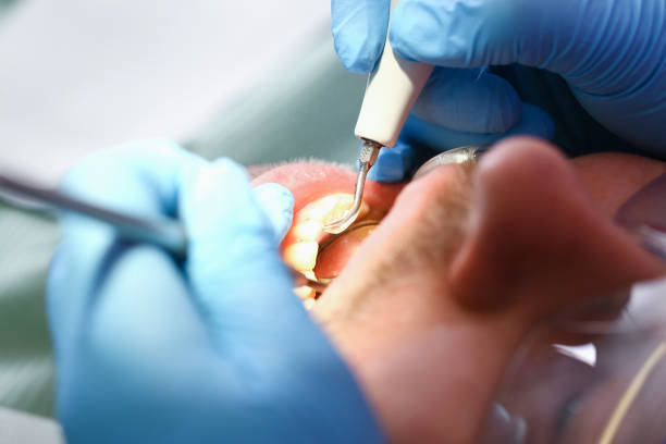 Best Tooth Pain Emergency Relief  in Hennessey, OK